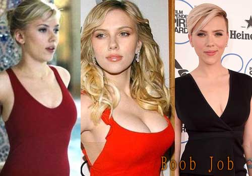 Scarlett johannson boob job