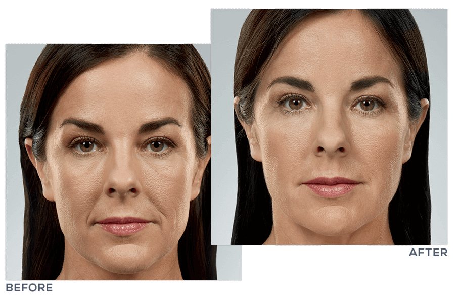 Lexus recommendet Best tinted facial moisturizer
