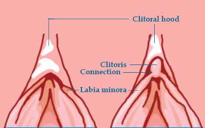 best of Painful clitoris Sensitive