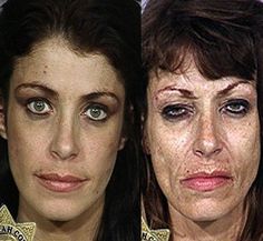 best of Abuse facial Crystal with