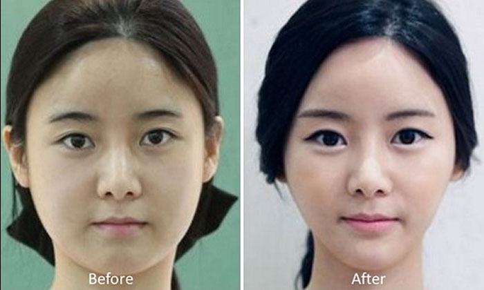 Asian plastic surgeons