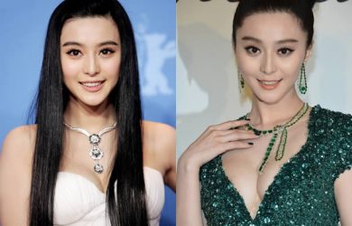 Asian celebrities plastic surgery