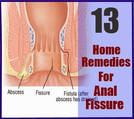 Anal fissures juice