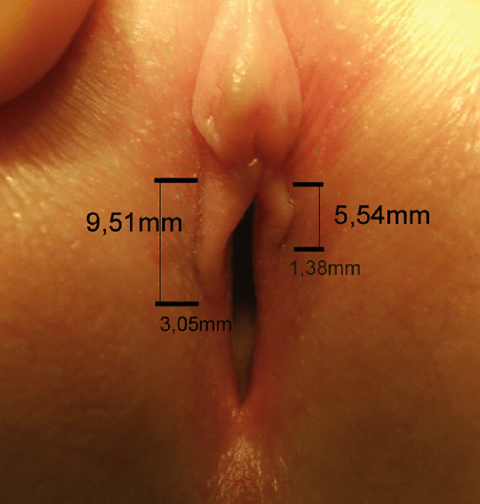 Increase vulva size
