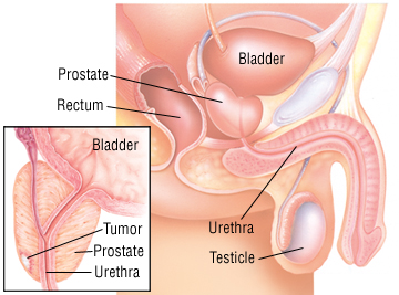 Robin H. reccomend Masturbation with prostatitis