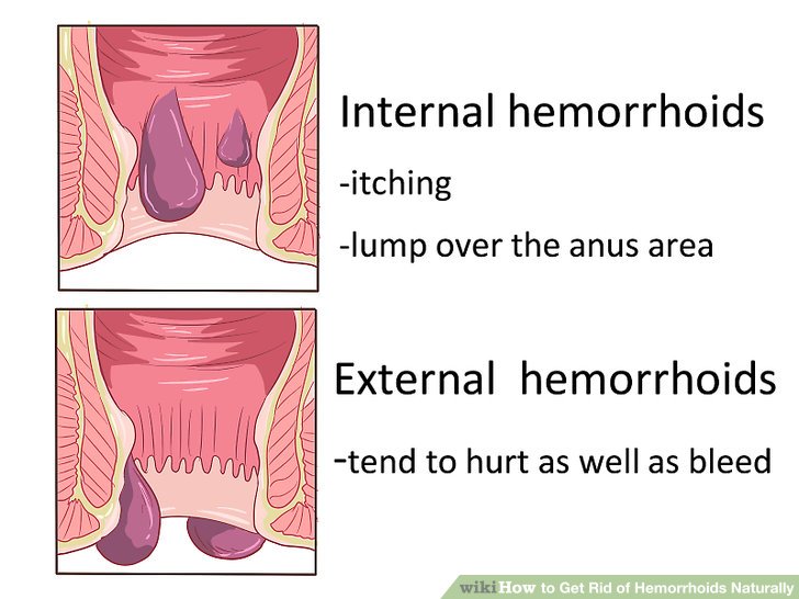 Itchy anus hurts year help