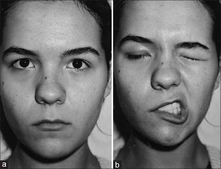Facial injuries study 1963