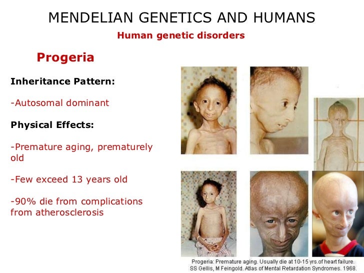 Paloma reccomend Human genetic facial disorders