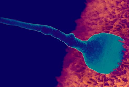 Fertilization pictures of egg sperm