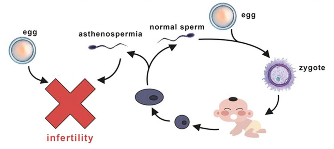 Impaired movement of sperm
