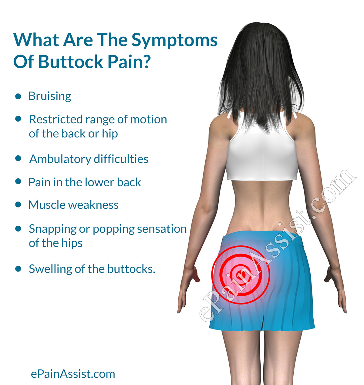 best of Anus Inflammation buttock