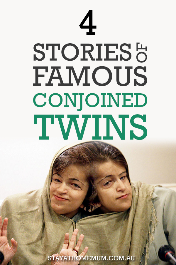 Joined adult film about conjoined twins