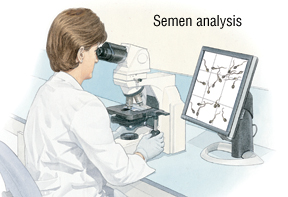 best of Analysis sperm Cost of