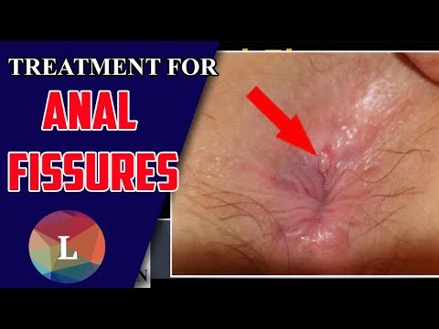 best of Sex injury cure Anal