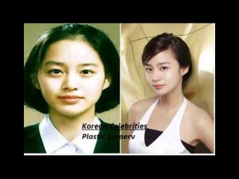 best of Plastic surgery celebrities Asian
