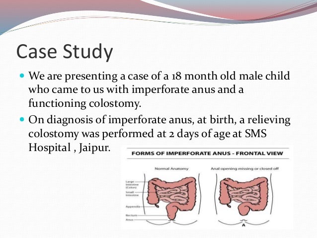 Nursing intervention for imperforate anus