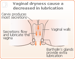 Do vagina lubrications cause yeast infections