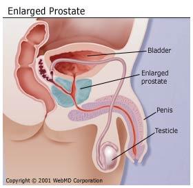best of With prostatitis Masturbation