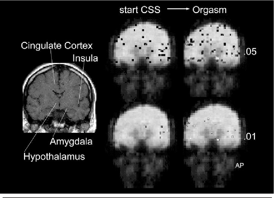 The brain during orgasm
