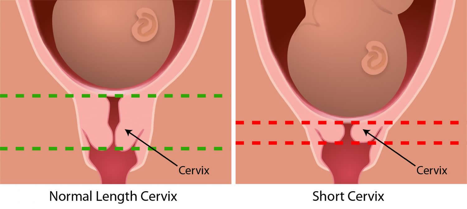 Gridiron reccomend Cervix contracting during orgasm