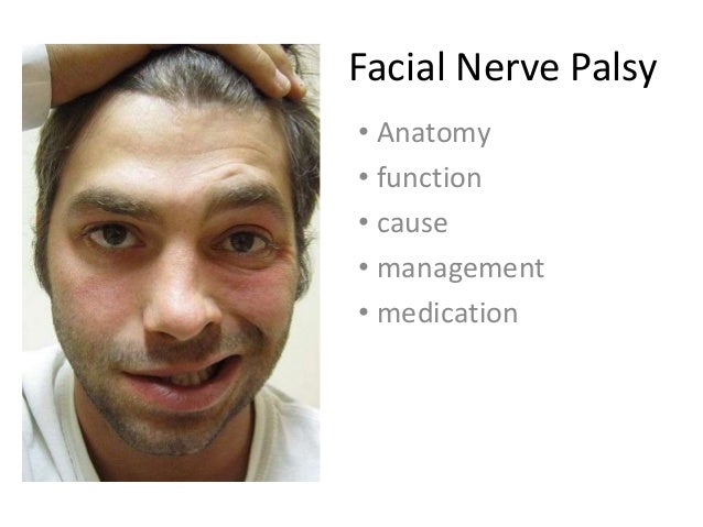 Bitsy reccomend Facial paralysis emedicine