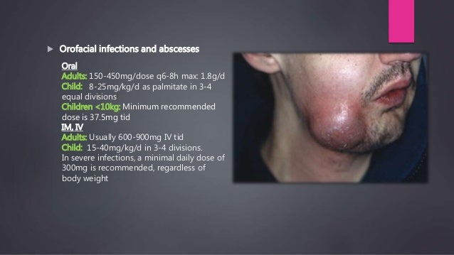 best of Clindamycin Facial skin abscess