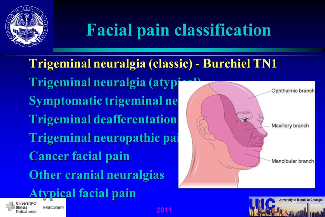Black M. reccomend Intractable facial pain
