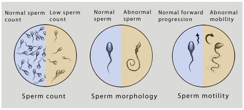 best of Sperm Male fertility motility and